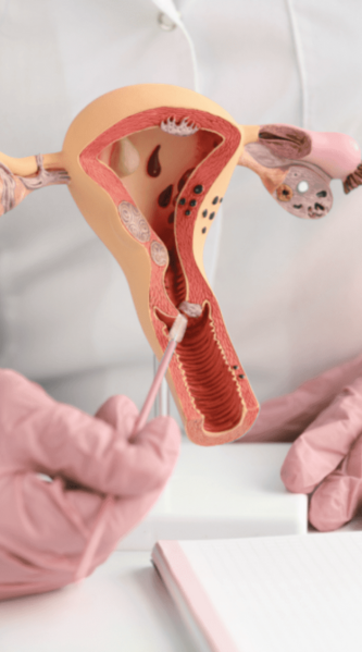 Dra Carmen Trota - Ginecologista em Juiz de Fora Especialista em Uroginecologia, PTGI, Microscopia Vaginal, Histeroscopia, Colposcopia, Climaterio e Menopausa Dra Carmen Trota Ginecologista em Juiz de Fora Ginecologista Ginecologia em Juiz de Fora Ginecologia Histeroscopia em Juiz de Fora Histeroscopia Colposcopia em Juiz de Fora Colposcopia Especialista em Menopausa Uroginecologista Uroginecologia Uroginecologista em Juiz de Fora